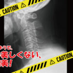 煽るわけではないのですが…  危険です!ストレートネック