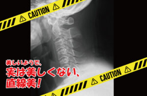 煽るわけではないのですが…  危険です！ストレートネック